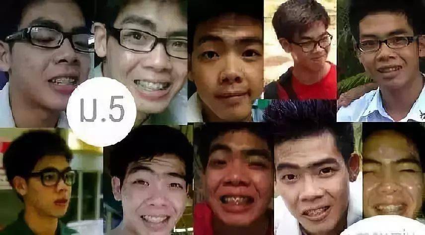 生活|泰国小哥花15万整形，成功从屌丝逆袭变男神！