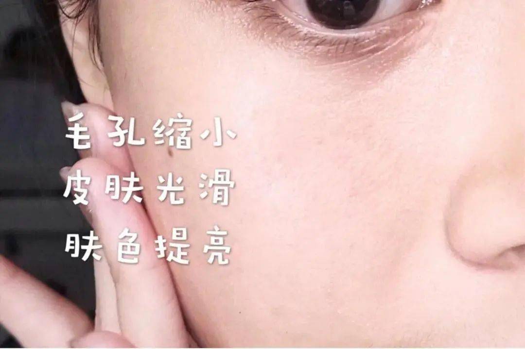 贫民窟|杨幂熬夜后护肤要花2万块？怪不得皮肤吹弹可破！贫民窟女孩就不配消除熬夜痘、黑眼圈吗？