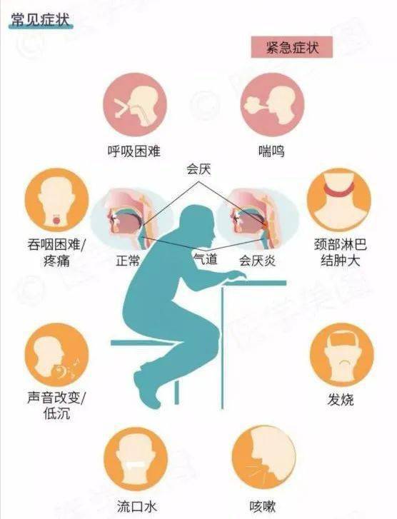 急性会厌炎有哪些表现?