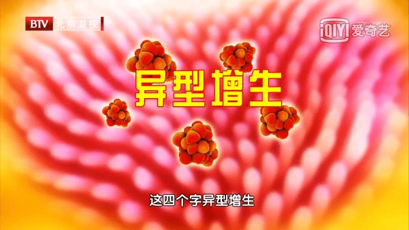 萎缩性|萎缩性胃炎、肠上皮化生是不是胃癌信号？真正需要警惕的改变是这个！
