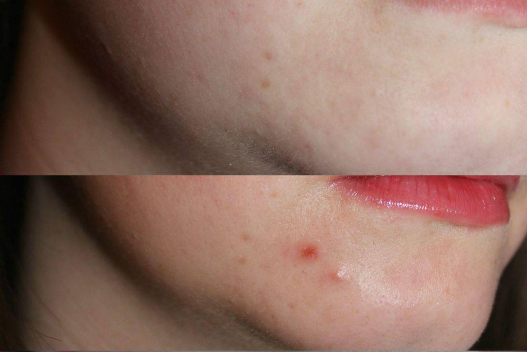 肌肤|又一明星夫妇宣布离婚!多少婚姻毁于这一点!