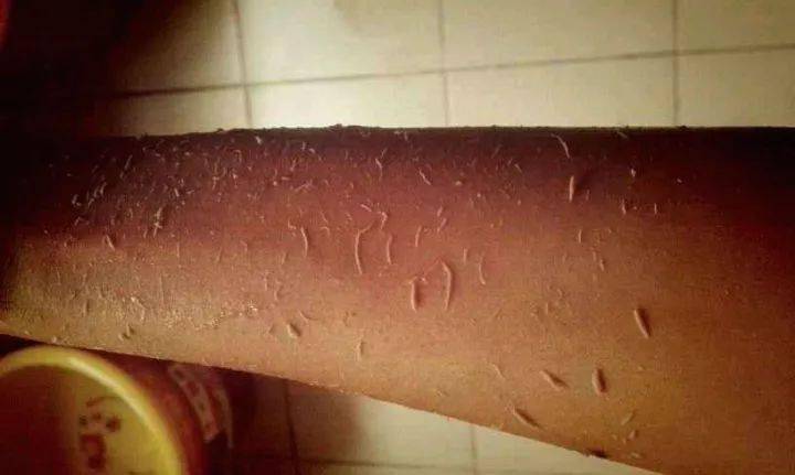 细胞|身上皮肤干，搓澡会不会伤皮肤？