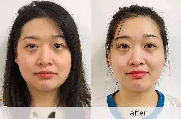 潘达|日本20年老木头,经1300°高温烧成“变态黑炭”,几分钟溶掉黑头,太神奇!