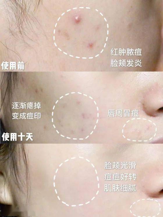 黑头|王霏霏太精明了吧！《浪姐》一播完，立马转行抢主播饭碗了？