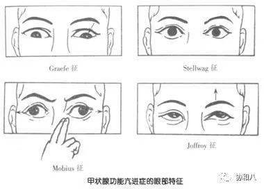 病变|溃疡性结肠炎 | 协和八·每日一题
