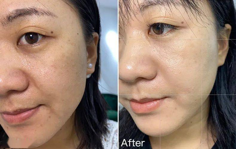 网友|47岁阿姨直播，“法令纹”2分钟磨平！网友炸锅：神仙操作！