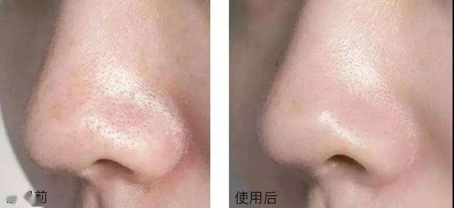 EviDenS|值得买｜三款列入「宝藏清单」的好用面膜 买过的人都在回购