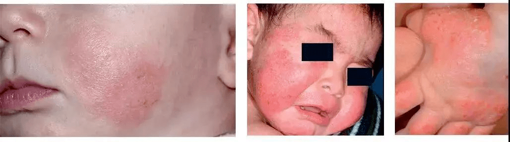 宝宝|长期使用孩子发育迟缓这8款宝宝霜千万别买！被查出偷加激素
