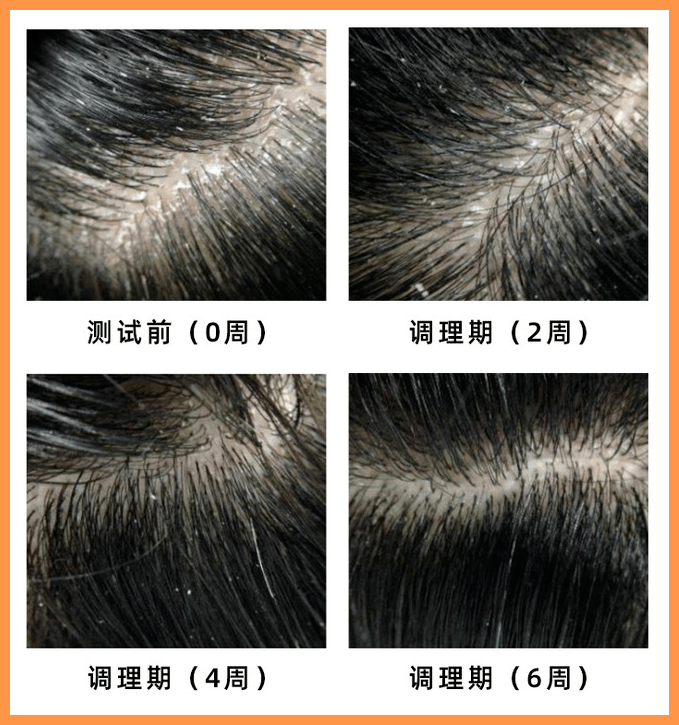 头发|均价不过60的头发护理好物，居然也能用出大牌护理的效果？！