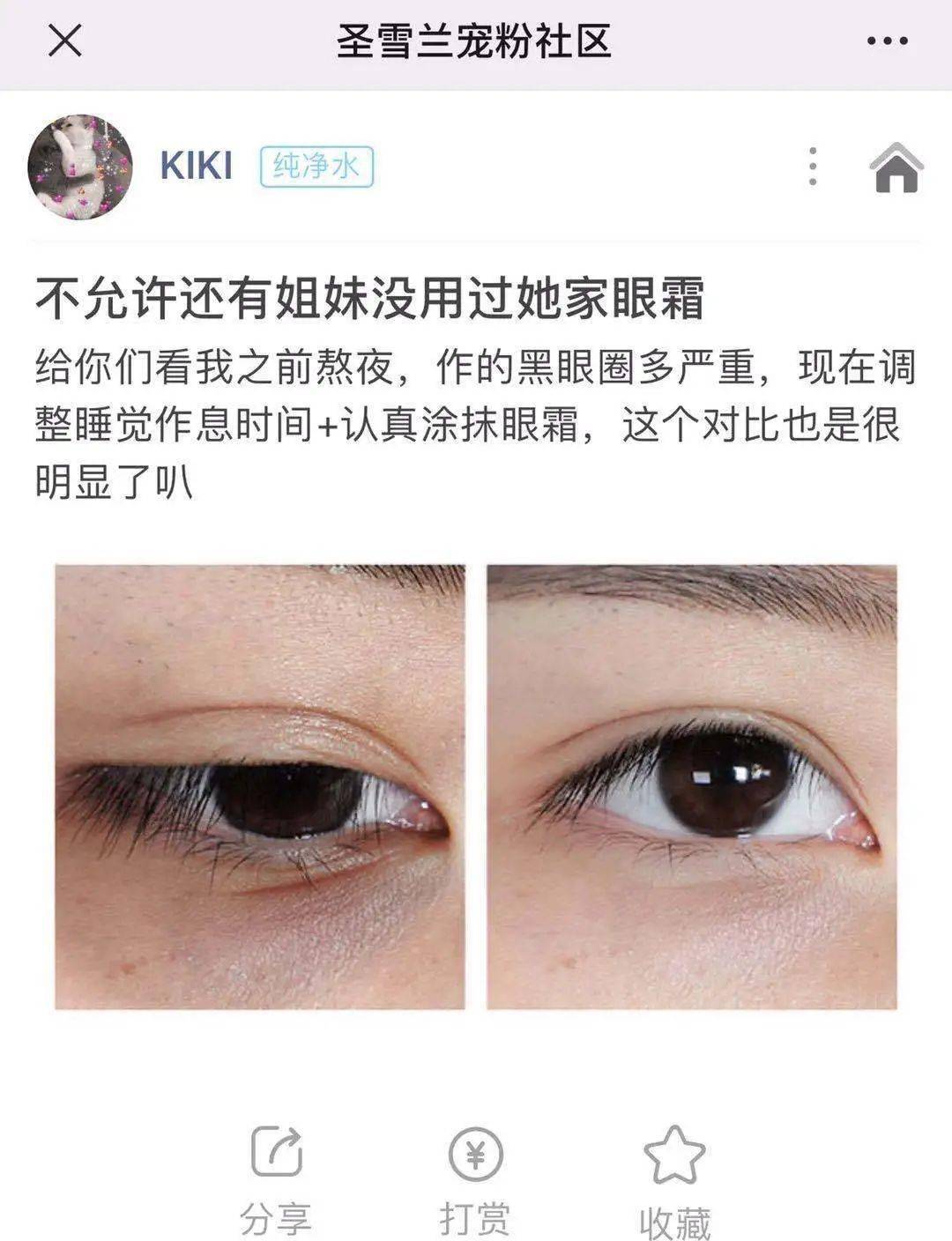 黑眼圈|实名推荐这款国货眼霜,99元去掉20年的熊猫眼,还不长脂肪粒!