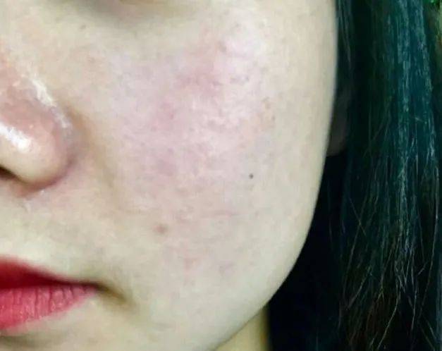 白成|黄轩录一天综艺就“黑化”，为啥同行的乔欣能躲过烈日，白成一道光？