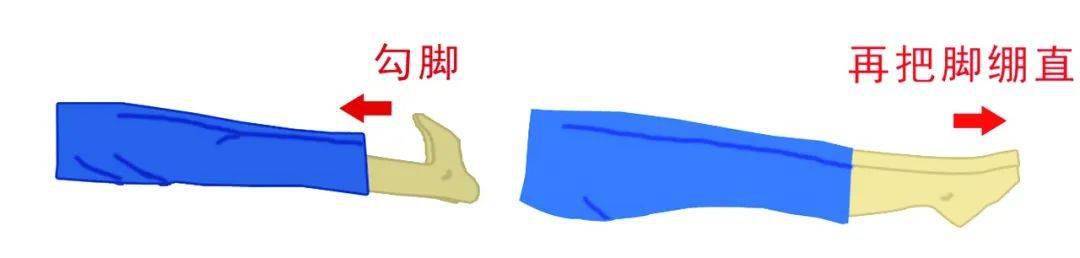 一分钟看懂髋关节置换术
