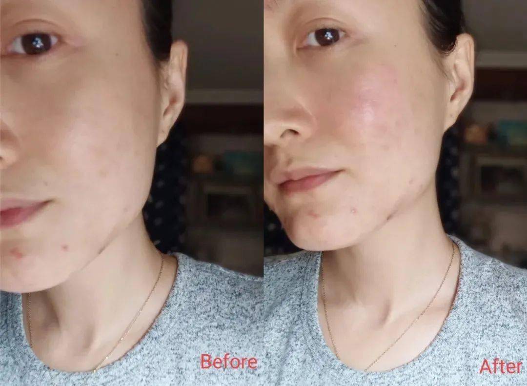 Bug|寻芳记｜换季肤况出Bug？听说比奶茶还甜的她们都用这招！