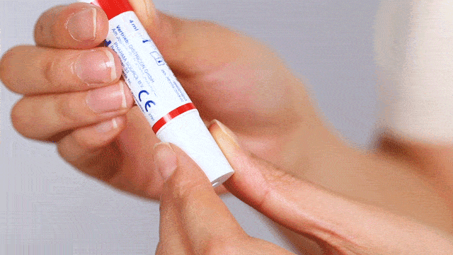 真菌|用“笔”刷一刷，灰指甲竟慢慢变光亮了