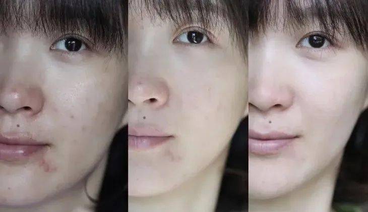 皮肤|2个小样=1个正装，雅诗兰黛小棕瓶套装降价了！价格直逼专柜3折