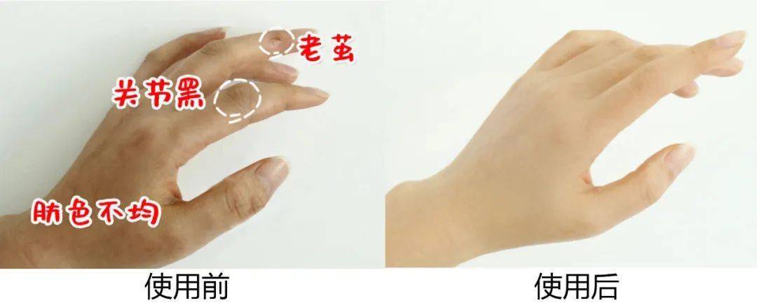 拖鞋|爱穿凉鞋、拖鞋出门的女人,脚上露出这个东西也太丑了吧~