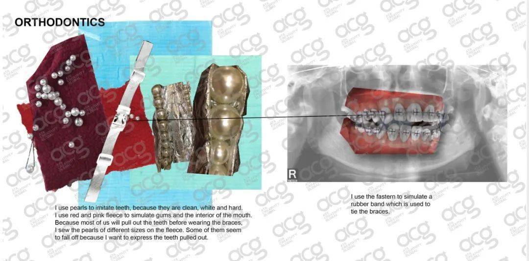 表演|因为追星Alexander Wang,我从影视表演跨界时尚拿到了4张offer!