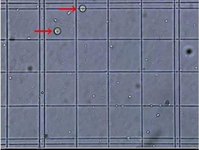 ①×5:将5个中方格的血小板数换算为1个大方格的血小板数;  ②×10