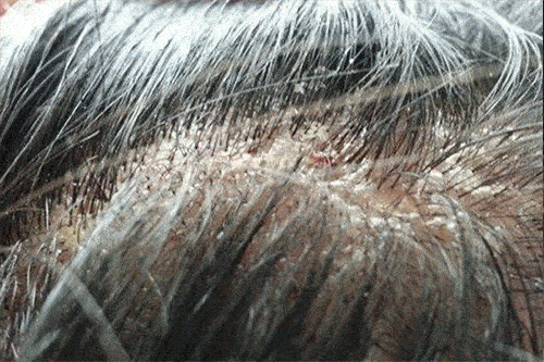 头发|头皮发痒，出油，还掉发？原来是你的洗发水没选好...