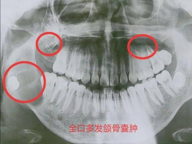 拔牙,就是简单的将牙齿扯出,真是这样吗?