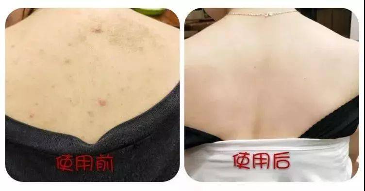 聚光灯|皮肤比丝绸还滑！涂上它自带“聚光灯”,这才是女人该有的样子！