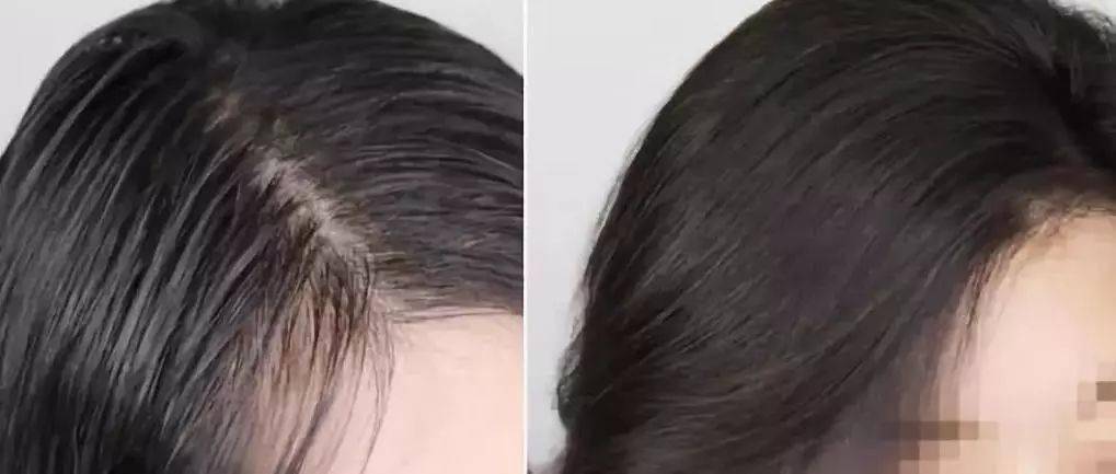 洗头|拯救细软塌,一喷一揉,头发随意蓬!