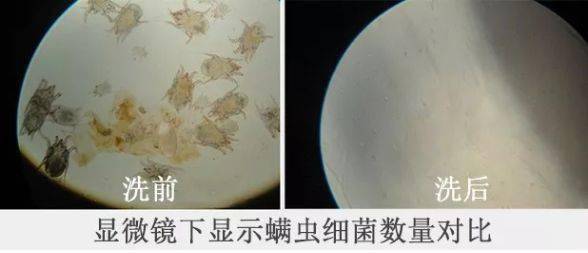 氨基酸|拒绝“螨虫脸”，5秒揉一揉，螨虫全出来了，痘痘黑头全没了！