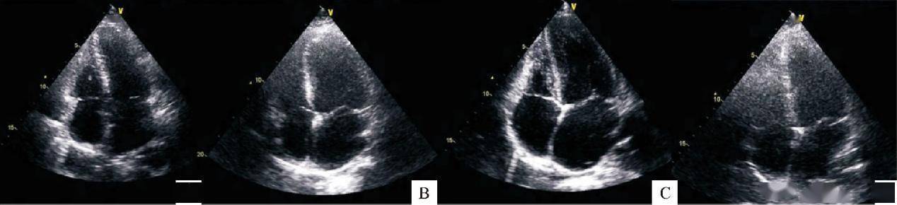 黑暗|全国高血压日｜被孕妈忽视的妊娠高血压到底有多“黑暗”？