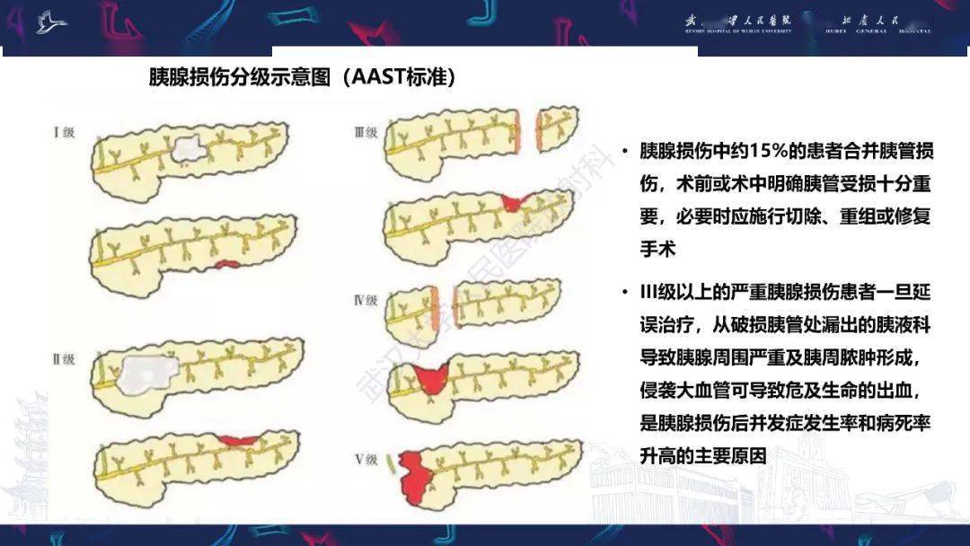 胰腺损伤影像诊断