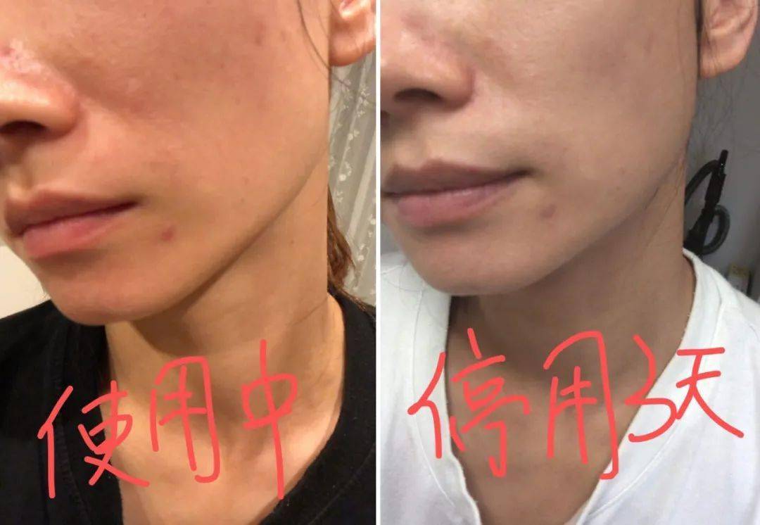 chiina|S航高颜值空姐代购假Lamer烂脸竟引路chiina网站?