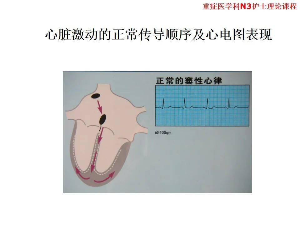 【ppt】异常心电图及常见心电图的识别及处理