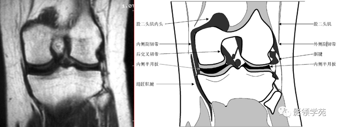 冠状面第三层冠状面第二层冠状面第一层2.