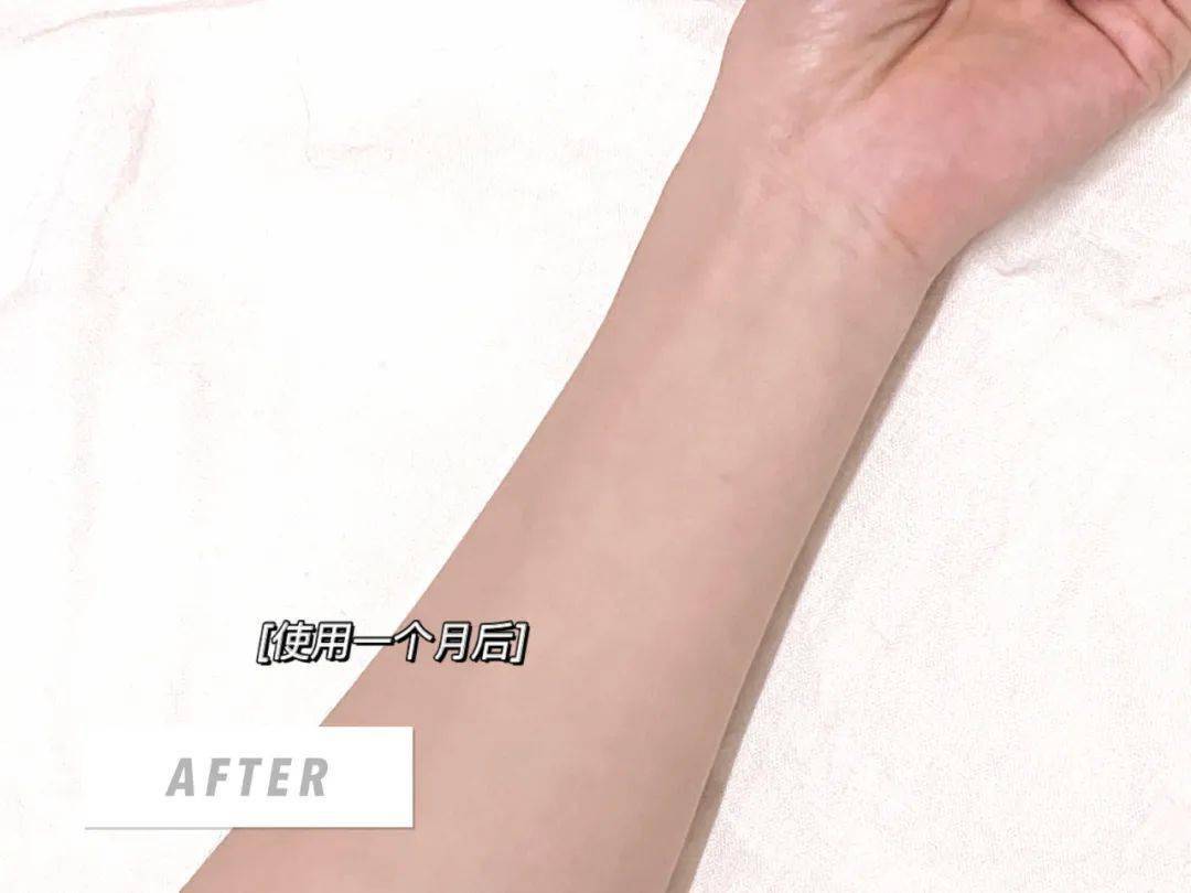 皮肤|穿衣小技巧,告别换季乱穿衣