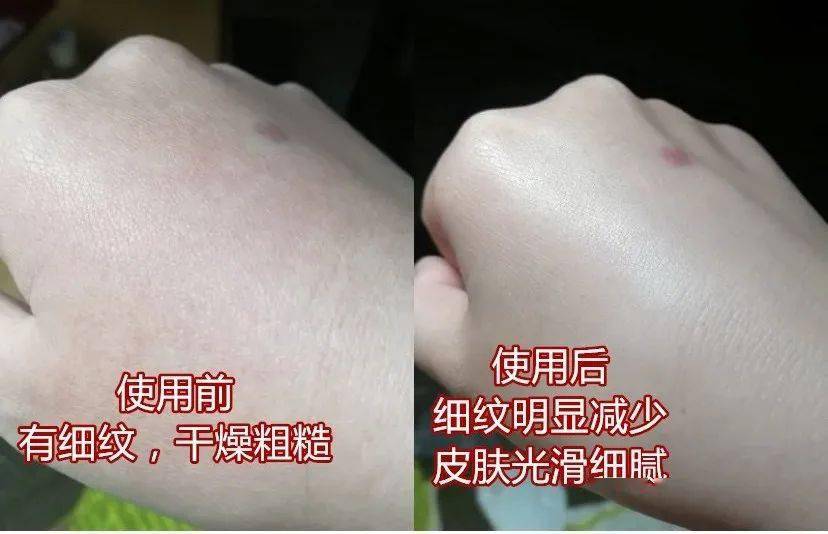 玫瑰|解决黑、干、糙，养出娇嫩双手，还买1送1