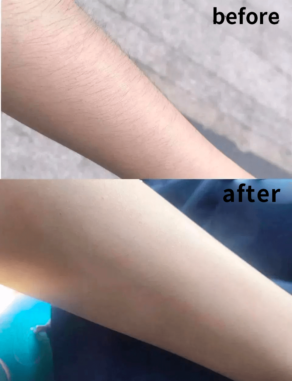 索兰|太狠！永久脱毛被我谈到99元，美白还嫩肤，秋季脱毛太机智了。