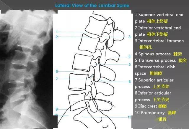 超详细的腰椎x线解剖及解读