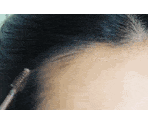 脸型|不整容也可以改变脸型？守住发际线就够了！