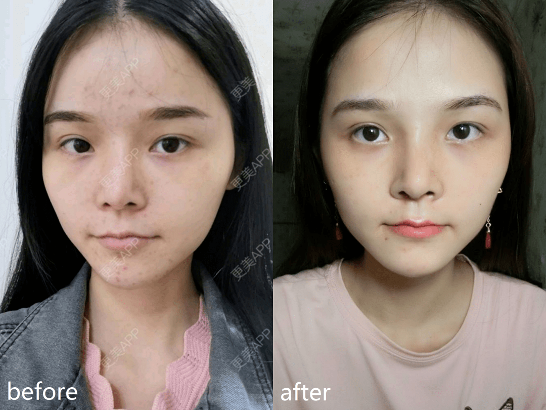 野心|钟楚曦素颜生图流出，她的野心也太大了...