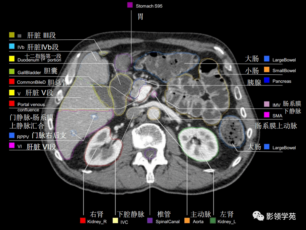 腹部影像学解剖图谱，详细篇！_医学
