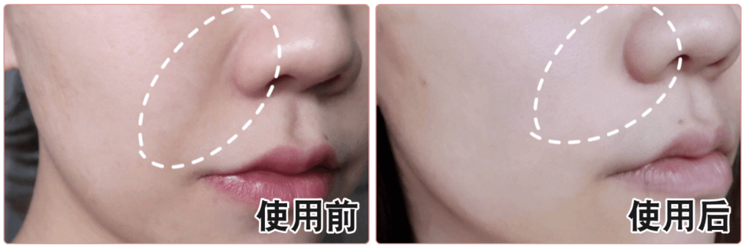 清洁|电动牙刷真的比普通牙刷好吗？我替你们问了医生