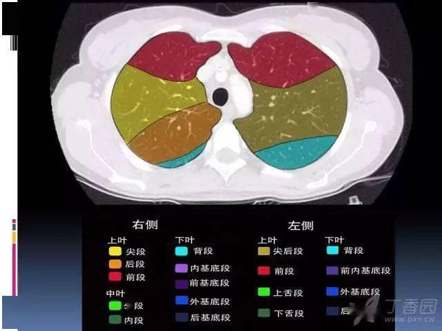 肺叶分段,支气管,肺动脉 ct 图谱全在这--值得收藏