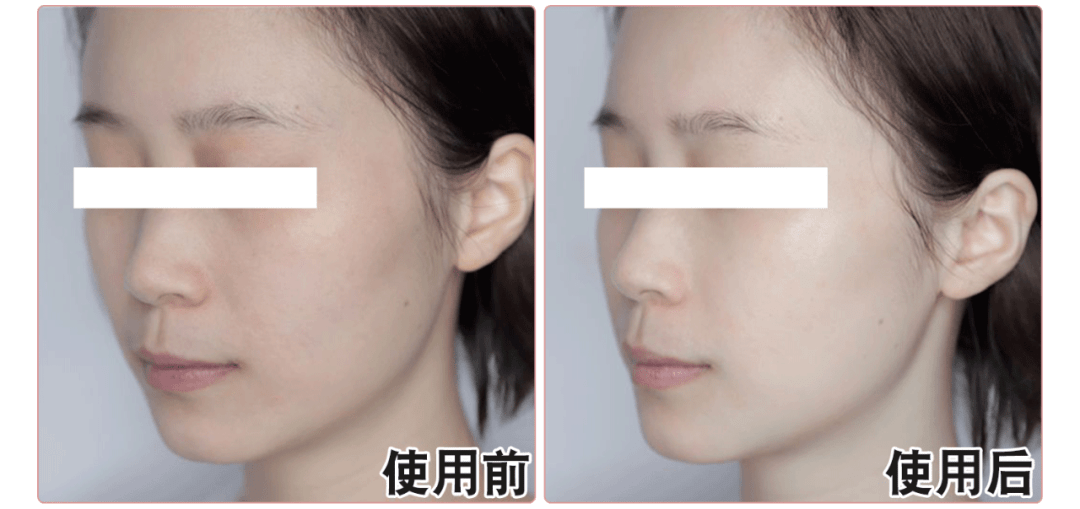 清洁|电动牙刷真的比普通牙刷好吗？我替你们问了医生