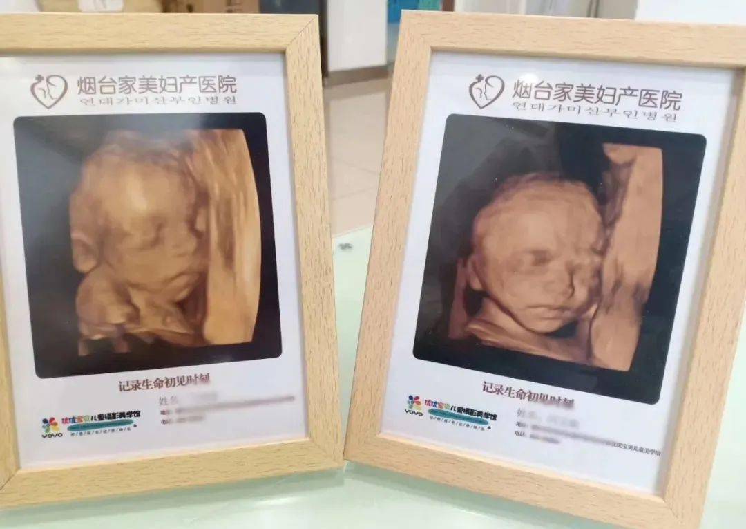 nt检查的时候那就是四维彩超有一项排畸检查绝对不能错过在孕24-28周