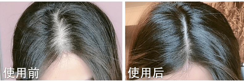 什么|连头发都快拼没了，你拿什么安身立命？