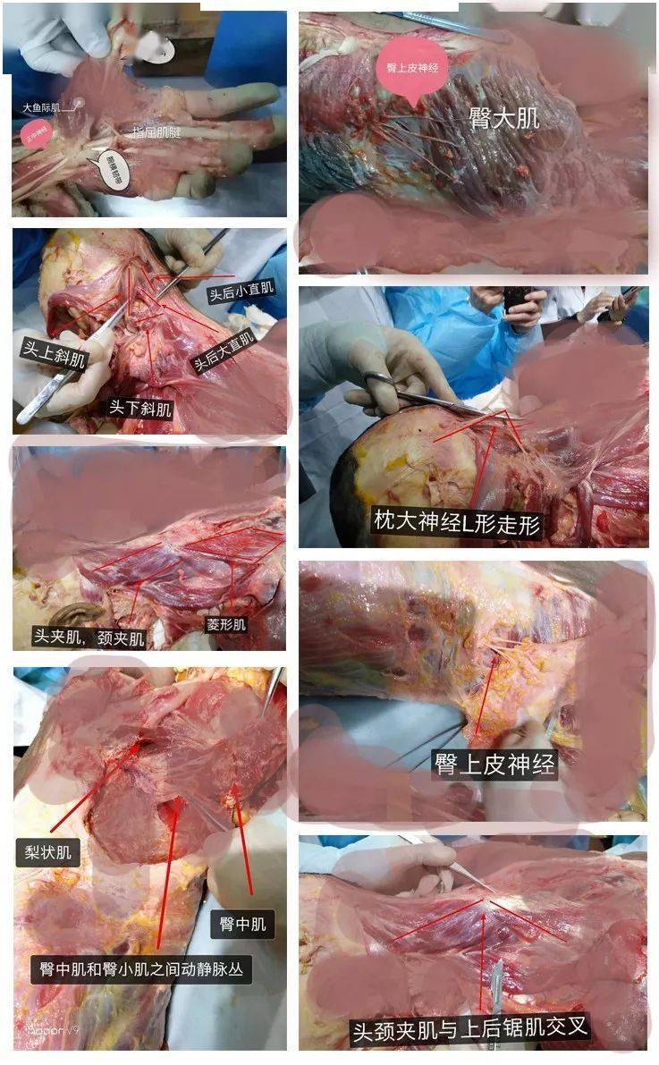 【11月27日-郑州】针刀微创新鲜人体解剖及疼痛科临床