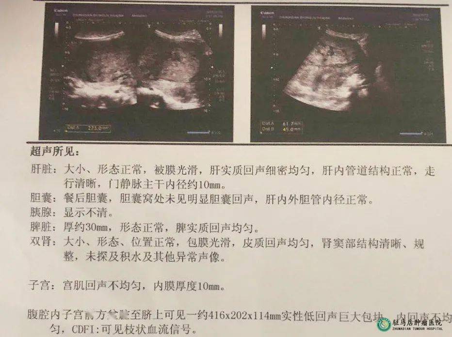 腹部彩超