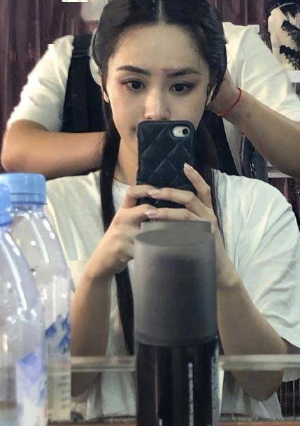 伤疤|阿娇受伤后亮相直播美出新高度，脸上不见伤疤，缝合百针恢复好