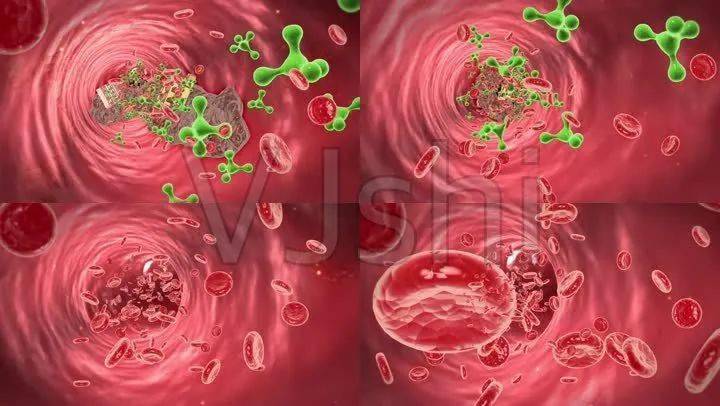 血液干净少生病血液淤堵疾病不断