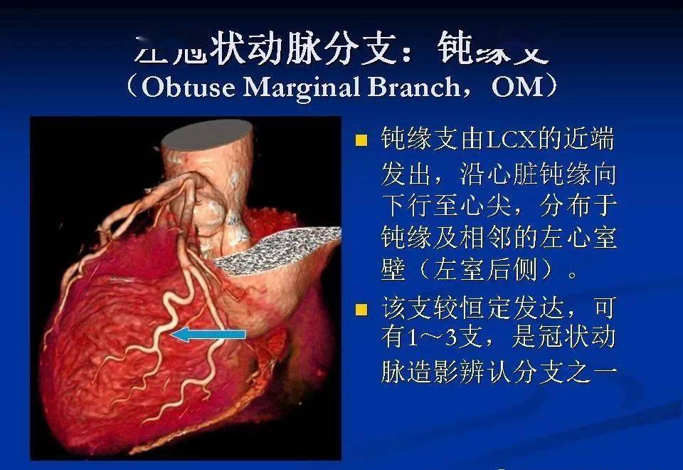 详细解读冠状动脉及冠心病ct