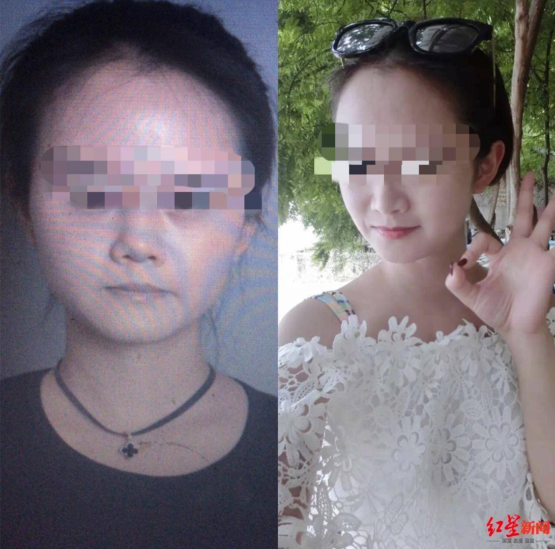 恒达官网整形悲剧:“成都赵丽颖”没当成,鼻子还变形 院方:手术确实出了问题 (图14) 恒达官网整形悲剧:“成都赵丽颖”没当成,鼻子还变形 院方:手术确实出了问题 (图14)